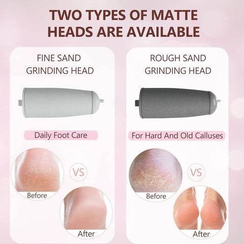 Rechargeable Electric Foot File Callus Remover