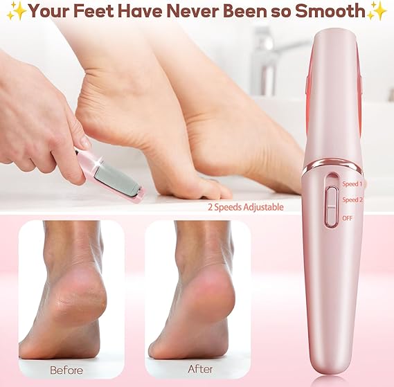 Rechargeable Electric Foot File Callus Remover